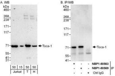 Western Blot: FNBP1L Antibody [NBP1-80569]