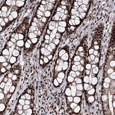 Immunohistochemistry-Paraffin: FNBP3 Antibody [NBP2-38400]