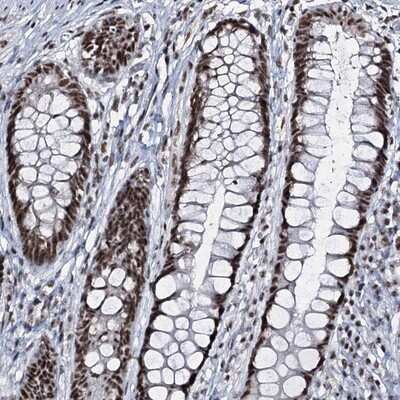 Immunohistochemistry-Paraffin: FNBP3 Antibody [NBP1-87933]