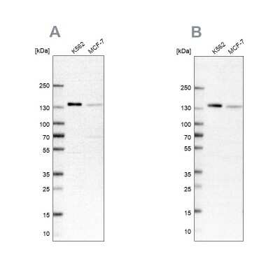 Western Blot: FNBP3 Antibody [NBP1-87933]