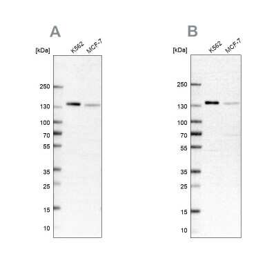 Western Blot: FNBP3 Antibody [NBP2-38400]