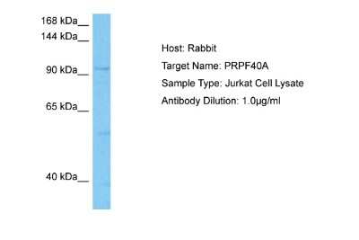 Western Blot: FNBP3 Antibody [NBP2-87456]