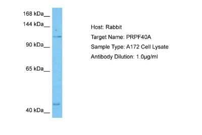 Western Blot: FNBP3 Antibody [NBP2-87458]