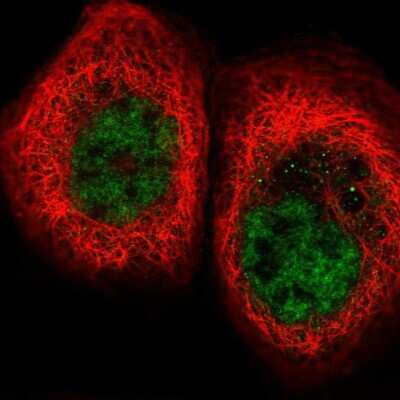 Immunocytochemistry/ Immunofluorescence: FNBP4 Antibody [NBP2-14021]