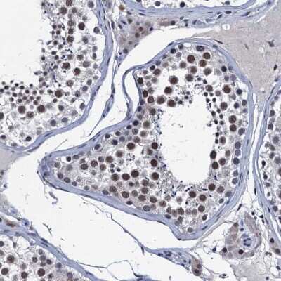 Immunohistochemistry-Paraffin: FNBP4 Antibody [NBP2-14021]