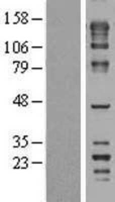 Western Blot: FNBP4 Overexpression Lysate [NBL1-10783]