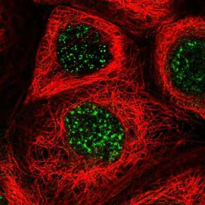 Immunocytochemistry/ Immunofluorescence: FNDC1 Antibody [NBP2-48602]