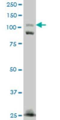 Western Blot: FNDC3A Antibody (2H4) [H00022862-M01]