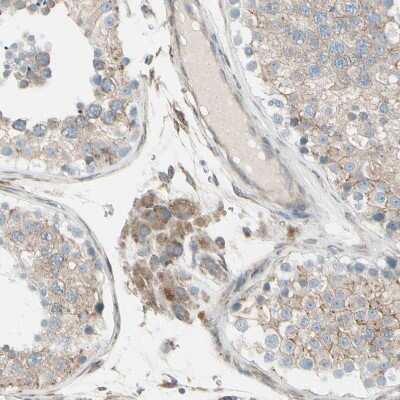 Immunohistochemistry-Paraffin: FNDC3A Antibody [NBP1-88809]
