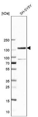 Western Blot: FNDC3A Antibody [NBP1-88809]