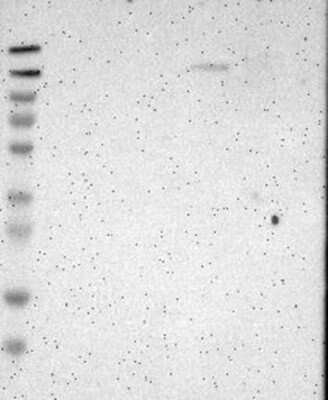 Western Blot: FNDC3A Antibody [NBP3-17849]