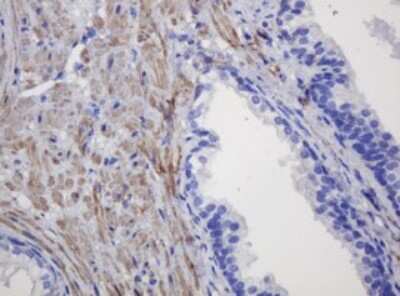 Immunohistochemistry: FNDC4 Antibody (OTI1B7) [NBP2-45691]
