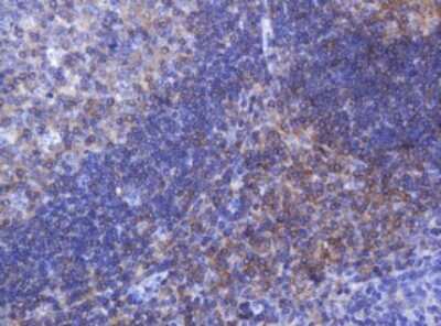 Immunohistochemistry: FNDC4 Antibody (OTI1B7) [NBP2-45691]