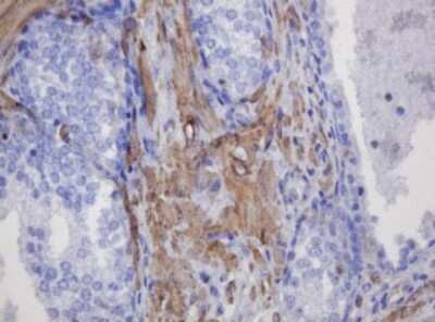 Immunohistochemistry: FNDC4 Antibody (OTI1B7) [NBP2-45691]