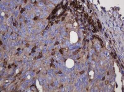 Immunohistochemistry: FNDC4 Antibody (OTI1B7) [NBP2-45691]