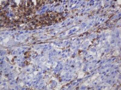 Immunohistochemistry: FNDC4 Antibody (OTI1B7) [NBP2-45691]