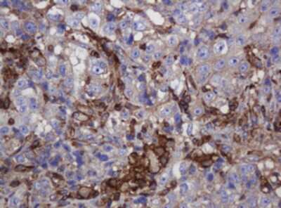 Immunohistochemistry: FNDC4 Antibody (OTI1B7) [NBP2-45691]