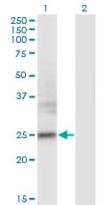 Western Blot: FNDC4 Antibody (7F9) [H00064838-M01]