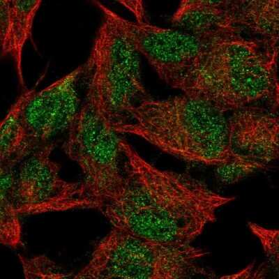 Immunocytochemistry/ Immunofluorescence: FNDC4 Antibody [NBP2-49397]