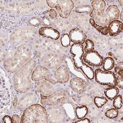 Immunohistochemistry-Paraffin: FNDC4 Antibody [NBP2-49397]