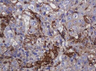 Immunohistochemistry: FNDC4 Antibody (OTI1B7) - Azide and BSA Free [NBP2-72151]