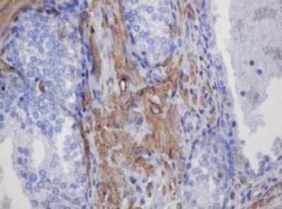 Immunohistochemistry: FNDC4 Antibody (OTI1B7) - Azide and BSA Free [NBP2-72151]