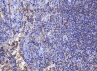 Immunohistochemistry: FNDC4 Antibody (OTI1B7) - Azide and BSA Free [NBP2-72151]