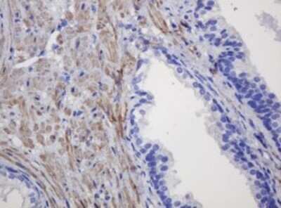 Immunohistochemistry: FNDC4 Antibody (OTI1B7) - Azide and BSA Free [NBP2-72151]