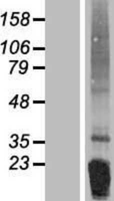 Western Blot: Irisin/FNDC5 Overexpression Lysate [NBP2-05226]