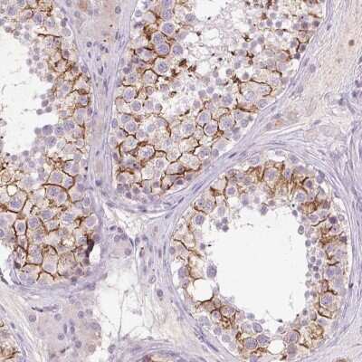 Immunohistochemistry: FNDC7 Antibody [NBP2-38722]