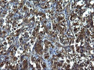 Immunohistochemistry: FNDC8 Antibody (OTI1C10) [NBP2-45692]