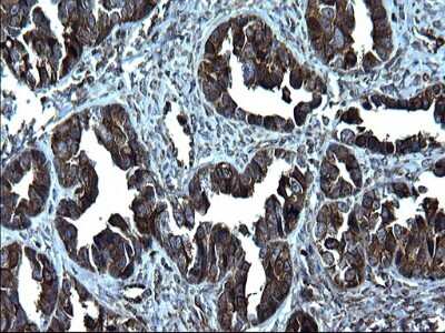 Immunohistochemistry: FNDC8 Antibody (OTI1C10) [NBP2-45692]