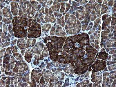 Immunohistochemistry: FNDC8 Antibody (OTI1C10) [NBP2-45692]