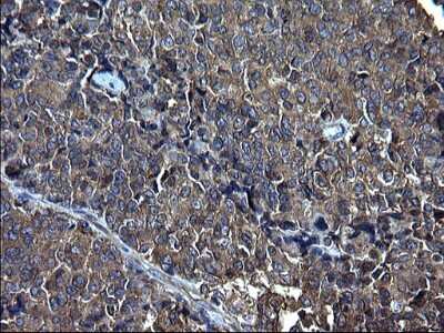 Immunohistochemistry: FNDC8 Antibody (OTI1C10) [NBP2-45692]