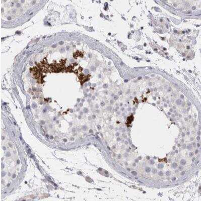 Immunohistochemistry-Paraffin: FNDC8 Antibody [NBP1-85121]