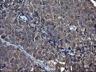 Immunohistochemistry: FNDC8 Antibody (OTI1C10) - Azide and BSA Free [NBP2-71966]