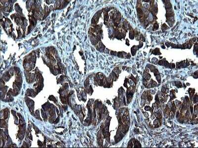 Immunohistochemistry: FNDC8 Antibody (OTI1C10) - Azide and BSA Free [NBP2-71966]