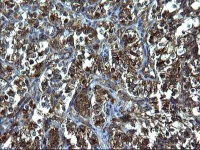 Immunohistochemistry: FNDC8 Antibody (OTI1C10) - Azide and BSA Free [NBP2-71966]