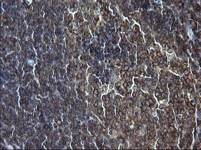 Immunohistochemistry: FNDC8 Antibody (OTI1C10) - Azide and BSA Free [NBP2-71966]