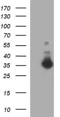 Western Blot: FNDC8 Antibody (OTI1C10)Azide and BSA Free [NBP2-71966]