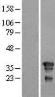 Western Blot: FNDC8 Overexpression Lysate [NBL1-10787]