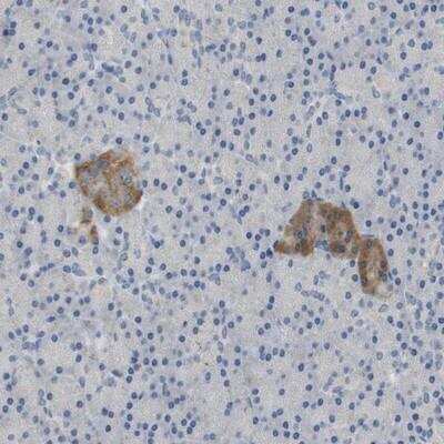 Immunohistochemistry: FNDC9 Antibody [NBP1-86770]