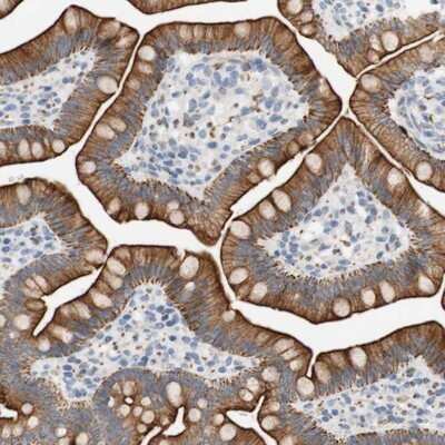 Immunohistochemistry-Paraffin: FNDC9 Antibody [NBP1-86771]