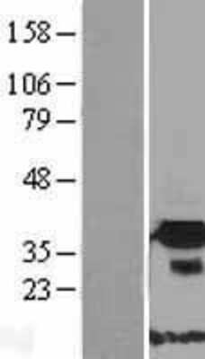 Western Blot: FNDC9 Overexpression Lysate [NBP2-08976]