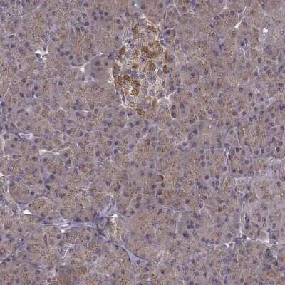 Immunohistochemistry: FNIP2 Antibody [NBP2-68936]