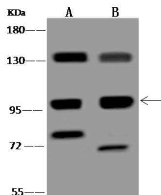 Western Blot: FNIP2 Antibody [NBP3-12667]