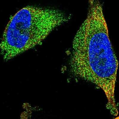Immunocytochemistry/ Immunofluorescence: FNTA Antibody [NBP1-83428]