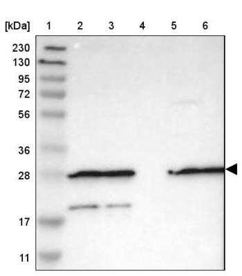 Western Blot: FNTA Antibody [NBP1-83428]