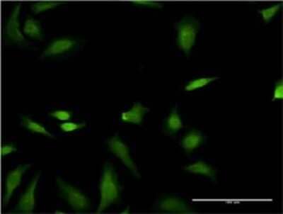 Immunocytochemistry/ Immunofluorescence: FNTB Antibody (3A9) [H00002342-M01]