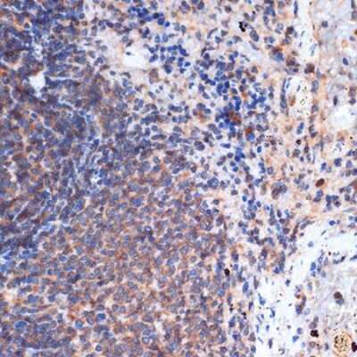 Immunohistochemistry-Paraffin: FNTB Antibody (3I4X5) [NBP3-15557]
